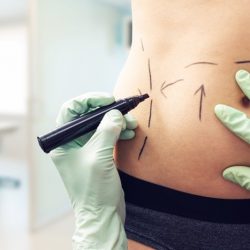 body-contouring-better-options body-contouring-better-options